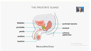 Anatomy of the prostate gland Diameters Weight shape and surfaces [upl. by Barden]