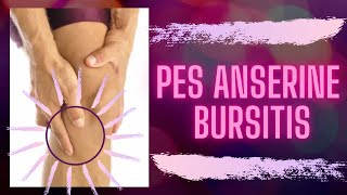 Pes Anserine Bursitis  Taping and Exercises for Effective Pain Relief  TriPhysio [upl. by Attenhoj]