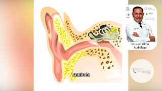 Hipoacusia conductiva definición causas síntomas y tratamiento [upl. by Chloette879]