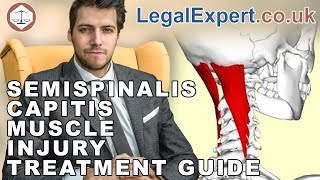 Semispinalis Capitis Muscle Injury Treatment Guide  2019  UK [upl. by Ennair]