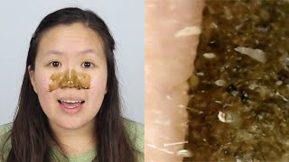 VZA Green Tea Blackhead Peel Off Mask  UNDER A MICROSCOPE [upl. by Eimas412]