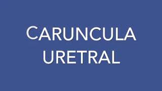 CARÚNCULA URETRAL [upl. by Ahsha]