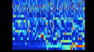 SCHIZOPHRENIA AS SOUND listening to the dynamic brain [upl. by Pascale]