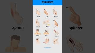 Types of injuries [upl. by Adlare]