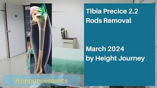 My Upcoming Tibia Rod Removal Surgery  March 2024 [upl. by Anitnahs]