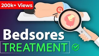 Bedsores Treatment  बेडसोर का इलाज [upl. by Odnamra374]