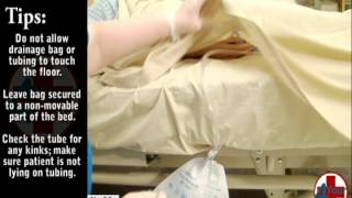 Emptying an Indwelling Catheter Drainage Bag [upl. by Delmore]