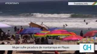 Mujer sufre picadura de mantarraya en Playas de Tijuana [upl. by Yesnik383]