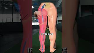 3Step Sciatica Fix [upl. by Initof]