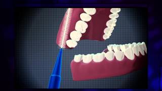 How to use an interdental brush effectively [upl. by Eruot462]