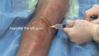 Superior Lateral Extended Knee GELSYN3 [upl. by Ainesej]