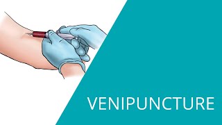 Venipuncture  How to take a blood sample by venipuncture [upl. by Pomona89]