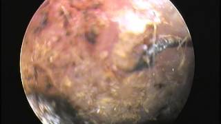 DES MOINES VETERINARY CARE VIDEO  Ear Mites Viewed with Video Otoscope at Ingersoll Animal Hospital [upl. by Annavahs]