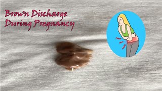 Brown Discharge During Pregnancy [upl. by Butcher345]