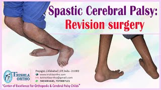 Spastic Cerebral Palsy  Revision surgery wmv [upl. by Odlaw]