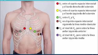 ¿CÓMO Y DÓNDE COLOCAR LOS ELECTRODOS PRECORDIALES [upl. by Wain]