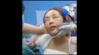 Facelifting 😱 beauty facelift transformation shwechuukoreaskincareandcosmetics [upl. by Behah]