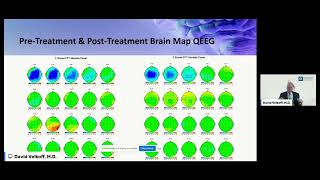 How Neurofeedback Improves Brain Functioning amp Reduces Autism Symptoms [upl. by Paris]