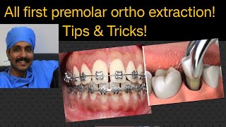 Ortho all premolar extraction technique sequence complications Extraction lecture by DrMurugavel [upl. by Nawiat]