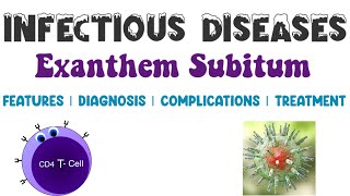 Exanthem Subitum  Viral Infections  Infectious Diseases 4  Medicine [upl. by Linea]