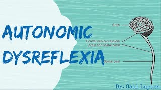 Autonomic Dysreflexia for Nursing Students [upl. by Calbert]