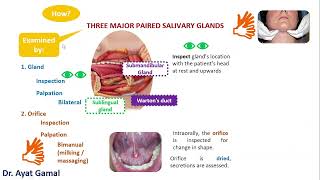 III Salivary glands how to examine parotid and submandibular SGs [upl. by Kirchner]