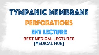 Tympanic membrane perforations types [upl. by Kahler]