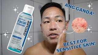 OXECURE ULTRA GENTLE FACIAL CLEANSER REVIEW FOR ONE MONTH  BEST FOR SENSITIVE SKIN AND BREAKOUTS [upl. by Nnayllek657]