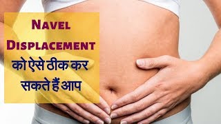 Navel Displacement Treatment using Acupressure Therapy  Shri Jagmohan Sachdeva [upl. by Merras]