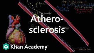 Atherosclerosis  Circulatory System and Disease  NCLEXRN  Khan Academy [upl. by Anauqal]