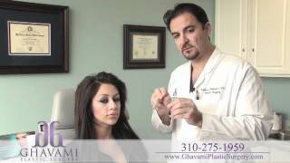 Custom Ethnic hispanic Rhinoplasty By Dr Ghavami [upl. by Xino246]