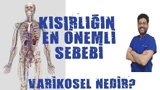 Varikosel Nedir ve Neden Olur [upl. by Esyle]