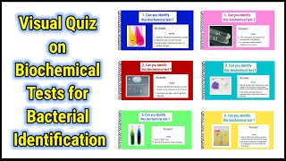 Visual Quiz on Biochemical tests for identification of bacteria  basicappliedmicrobiology [upl. by Lusa]