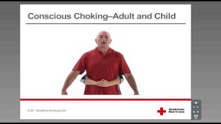 Conscious Choking  Adult and Child [upl. by Salomone550]