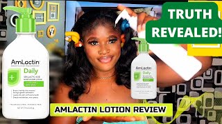 Amlactin Lotion Review Watch this before buying What Amlactin did to my skin Amlactin skincare [upl. by Lebana]