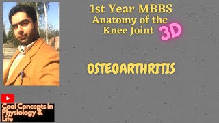 3D Anatomy Knee joint  Clinical Scenario  OSTEOARTHRITIS 1st year MBBS [upl. by Olatha770]