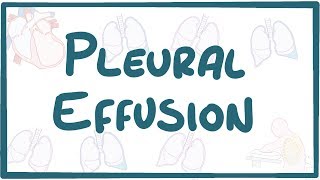 Pleural Effusion  causes symptoms diagnosis treatment pathology [upl. by Burrill]