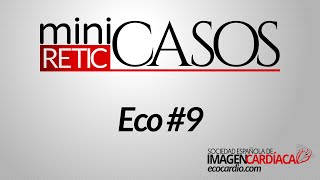 miniCASOS  Eco 9 [upl. by Ybreh]