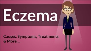 Eczema  Causes Symptoms Treatments amp More… [upl. by Enidualc]