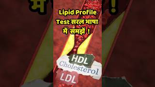 Lipid Profile Test Guide  HDL LDL Triglycerides Explained iskibhenkimajemaje shorts viralshort [upl. by Feinstein]