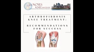 Arthrofibrosis Testimonial Ft Lauderdale [upl. by Meunier66]