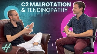 C2 Malrotation Mal de Débarquement Syndrome MdDS … and Scott’s long journey to miraculous health [upl. by Iniffit319]