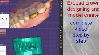 Exocad 30 Galway  How to Make ModelsMaking Models in ExocadExocad Model creatorexocad design [upl. by Aerdnahc]