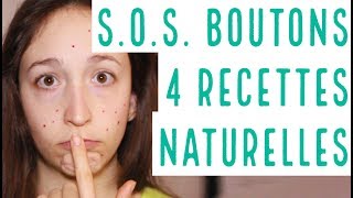 SOS BOUTONS  4 astuces MAISON pour les faire partir RAPIDEMENT et NATURELLEMENT [upl. by Onofredo]