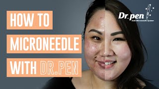 How to microneedle at home with Dr Pen  Dr Pen Australia  Microneedling  Skin Needling  CIT [upl. by Riem]