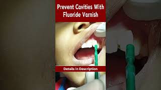 Prevent Cavities with Fluoride Varnish 🦷 cavities dental dentalshorts [upl. by Notnef11]