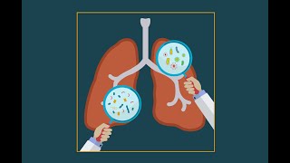 Pneumocystis jiroveci pneumonia pcp [upl. by Nibla]