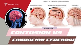 COTUSIÓN CEREBRAL VS CONMOCIÓN [upl. by Shargel243]