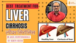 CIRRHOSIS LIVER  लीवर सिरोसिस  Homeopathic TREATMENT  Dr Aadil Chimthanawala  liver cirrhosis [upl. by Yanrahs]