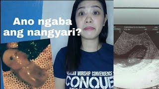 Miscarriage in early pregnancy  Tagalog  Story time [upl. by Atinreb61]